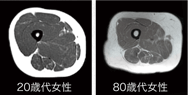 年代別筋肉量の比較（大腿筋肉）