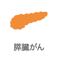 膵臓がん