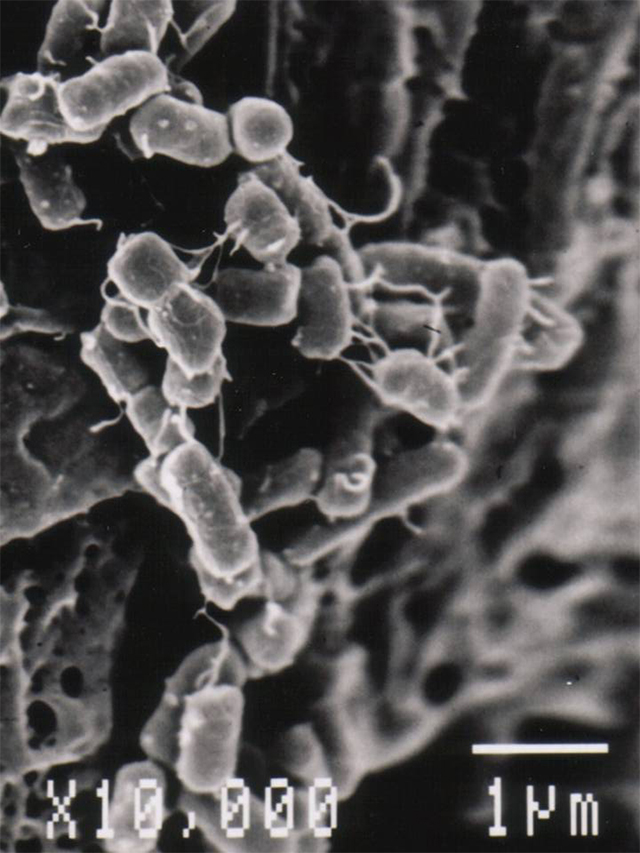 参考：腸管出血性大腸菌O157 SP画像
